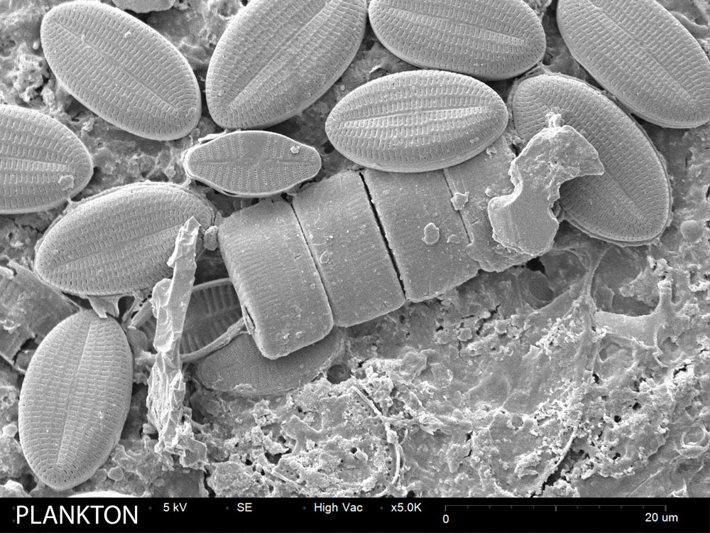 Plankton SEM image