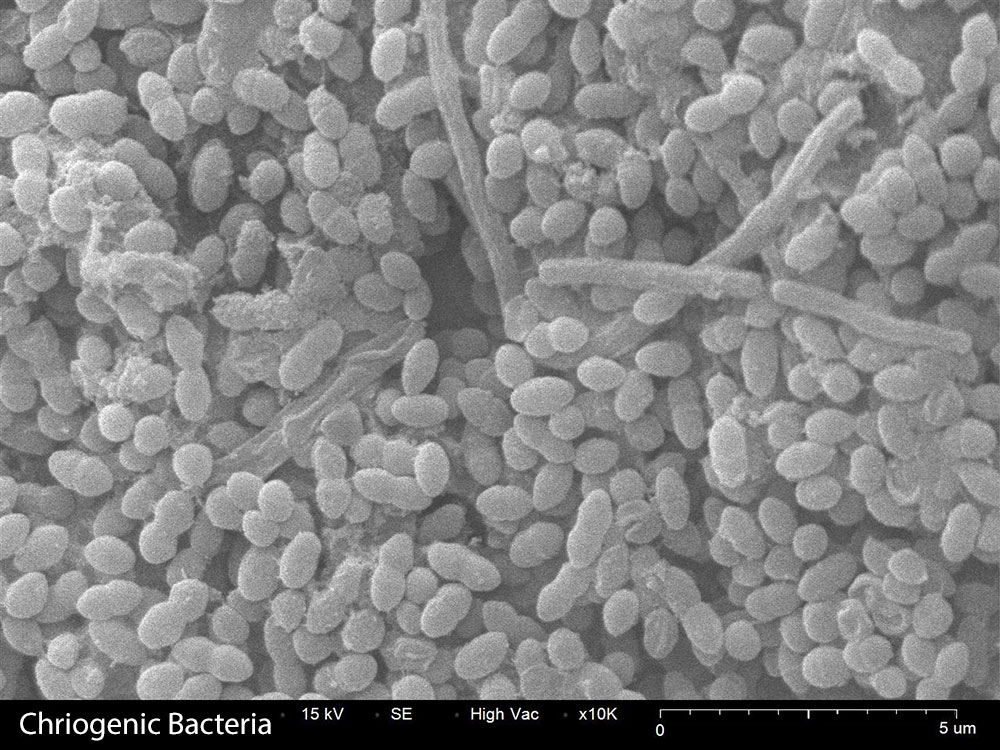 Chriogenic Bacteria SEM image 10,000X magnification